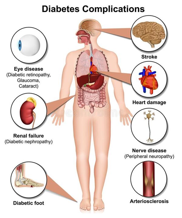 Consequências do diabetes